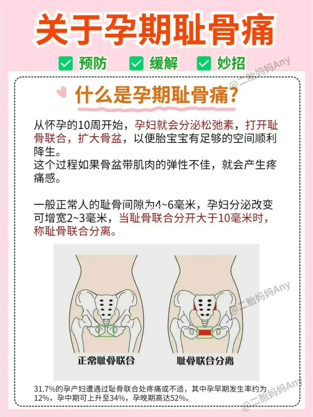 孕八个月阴部骨头疼痛的体验与应对