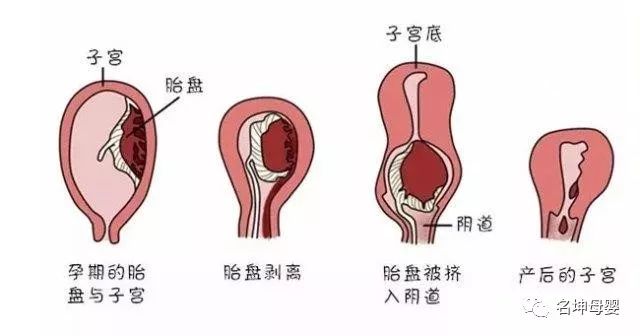 孕五个月漏尿现象解析