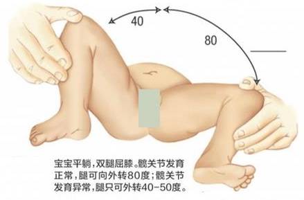 两个月宝宝腿粗细差异的观察与解析