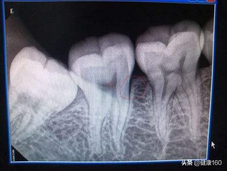 广东省口腔健康之旅，探索拍牙片的重要性