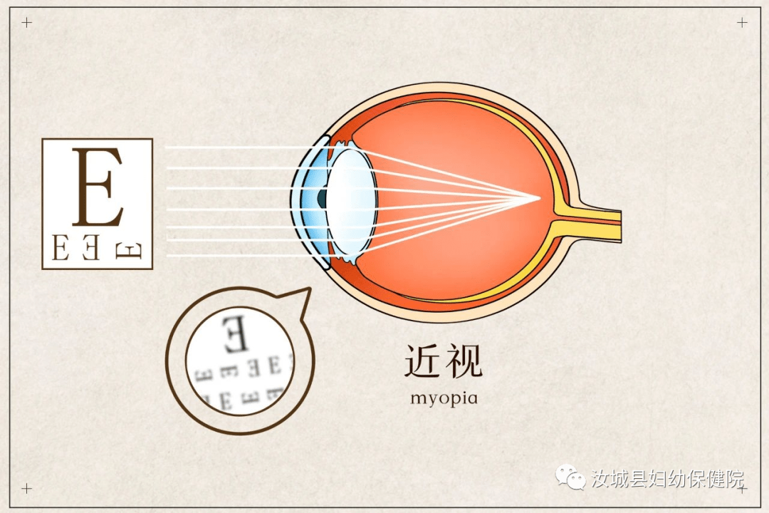 解析6个月宝宝视力正常范围